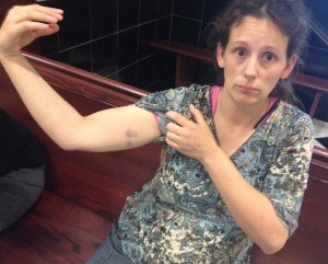 nicole-naugler-after-encounter-with-deputies