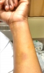 Julius' daughter bruised at the hands of hospital police.