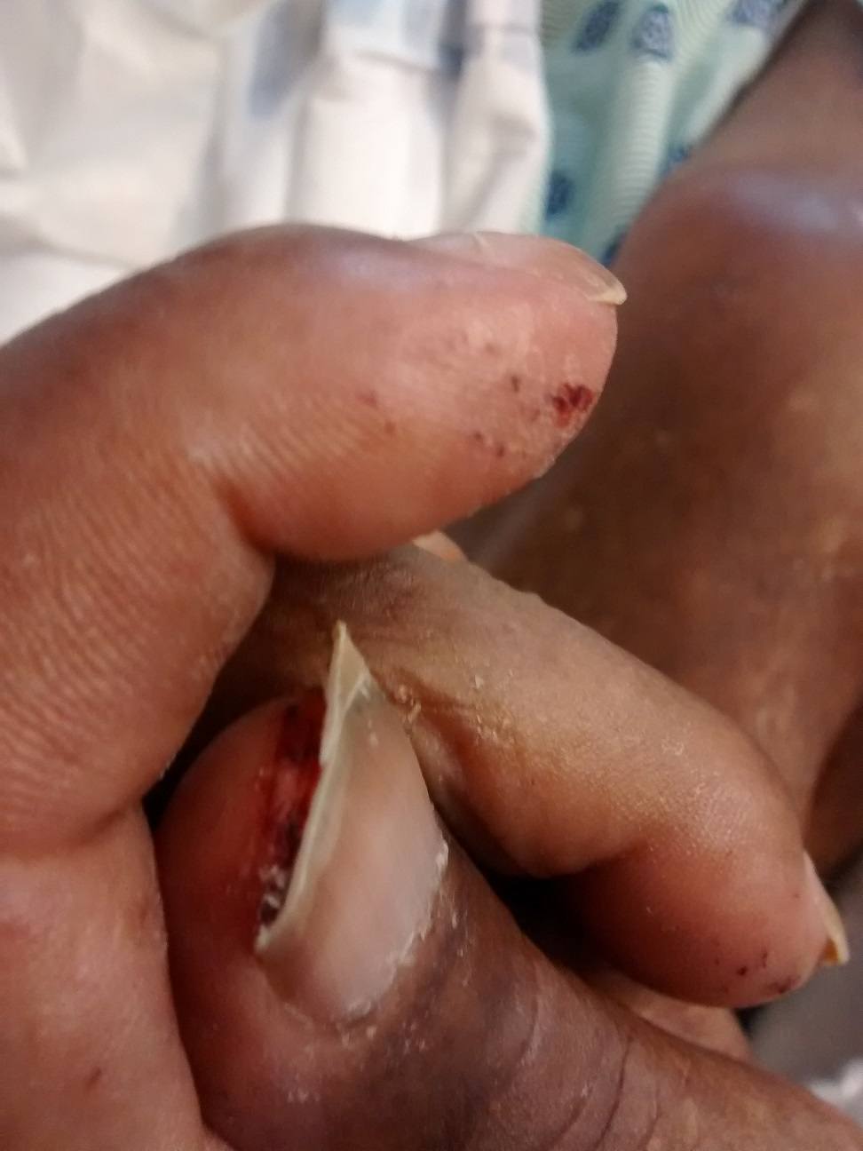 Julius-Corley-fingernails