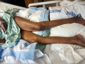 Julius Corley wasting away