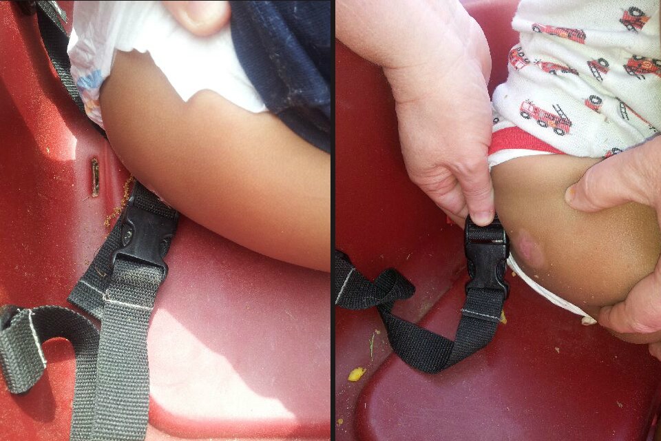 Malakai Zechariah burns