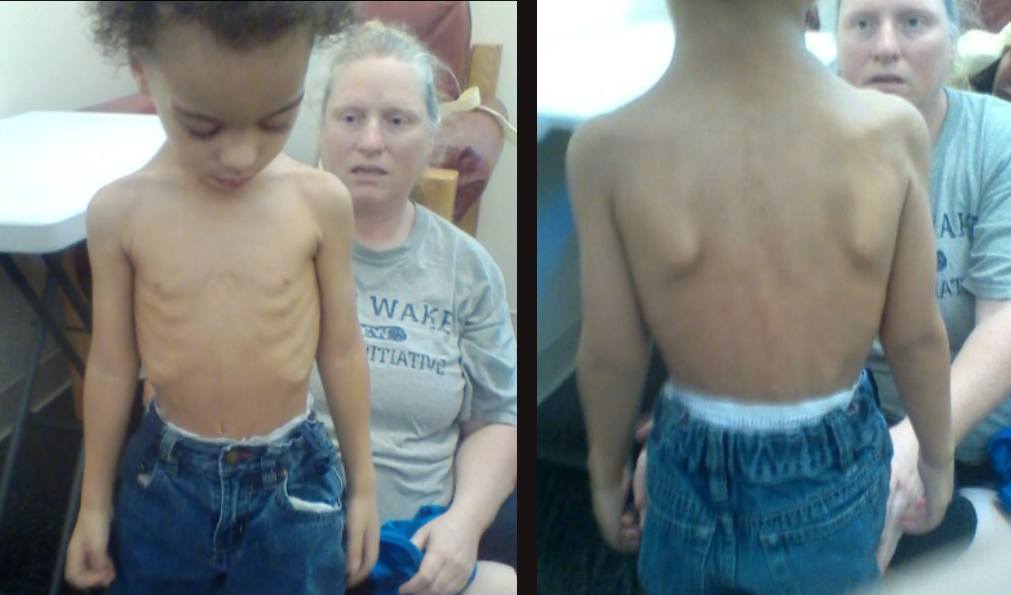 Malakai skin and bones photos