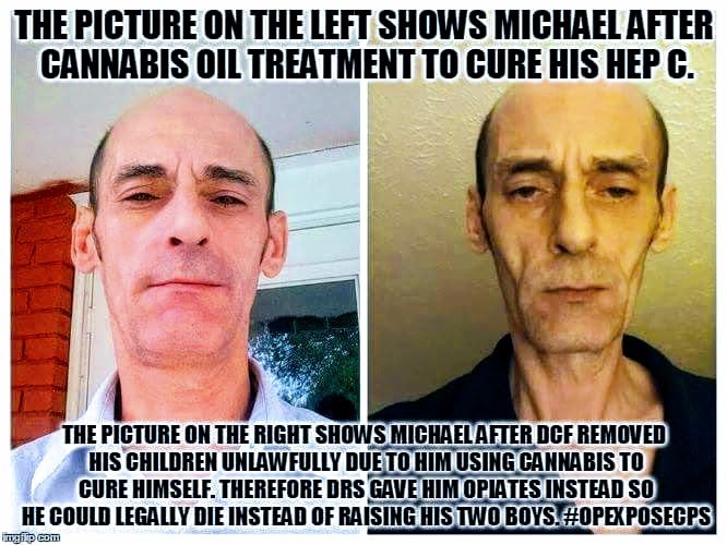 Brooks before and after