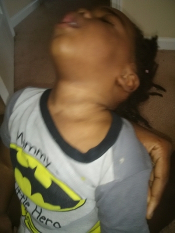 Durenda son after vaccines