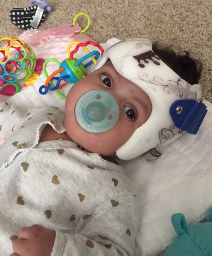 Glazier baby in helmet