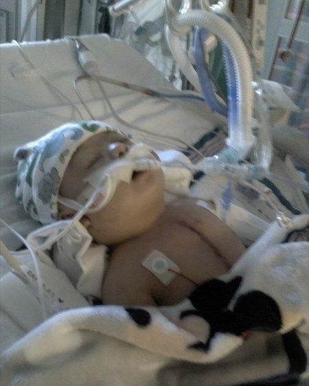 Steffen after heart surgery at 4 months