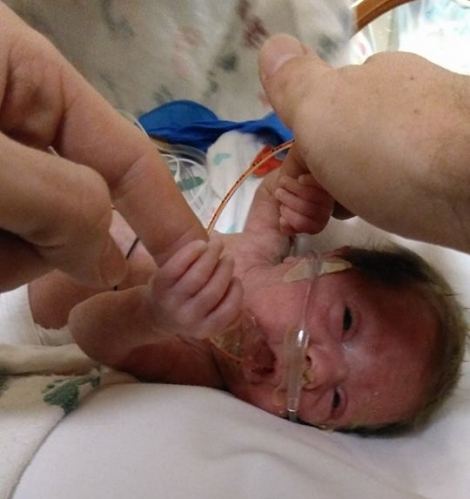 Yael preemie