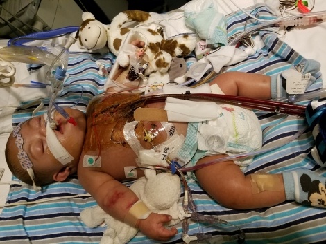 Steffen-on-life-support-2-e1496124682165