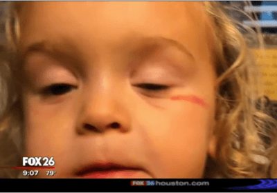 Randy Wallace Fox MK story Oct 2018 little girl black eye