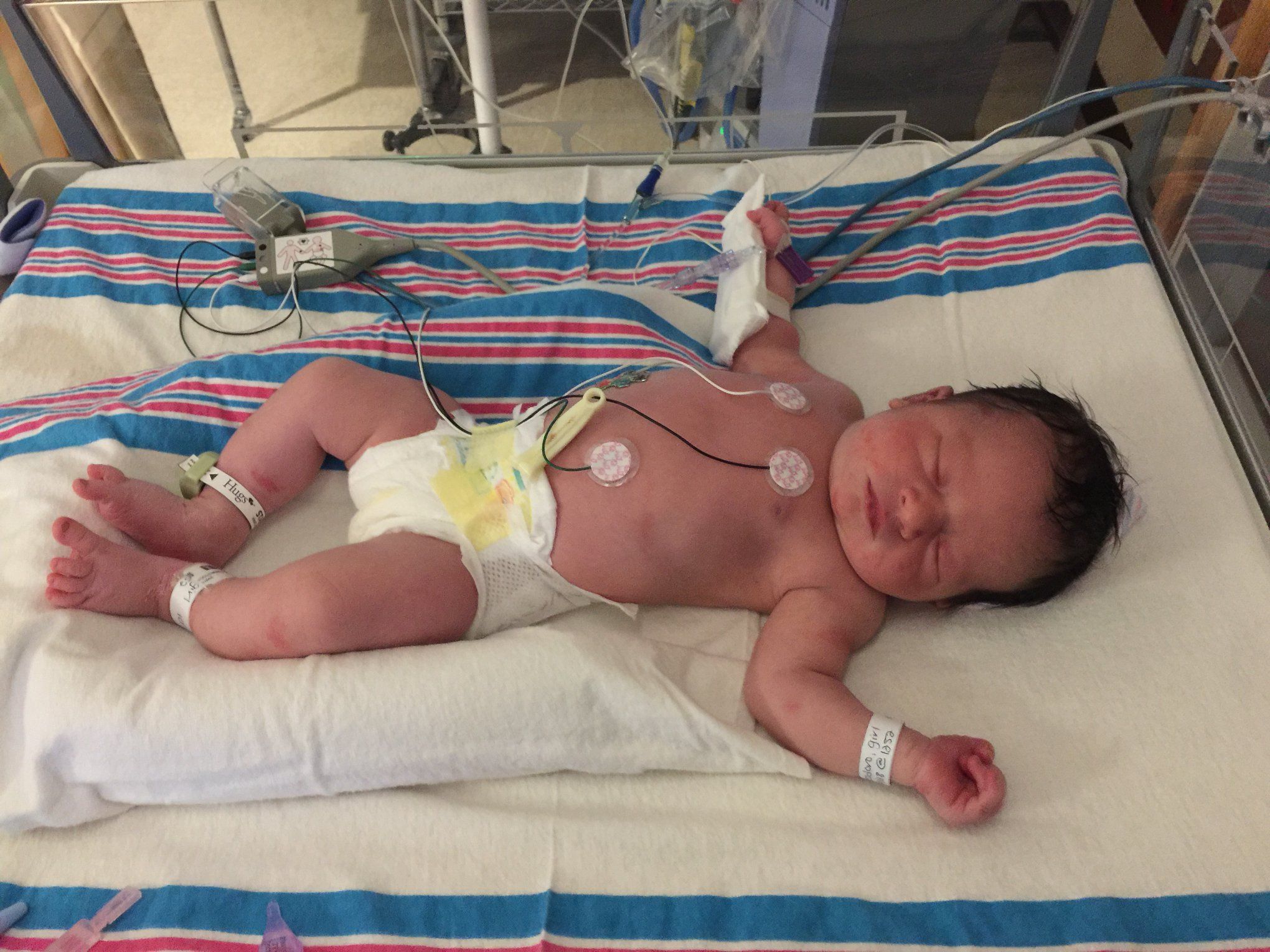 baby in hospital