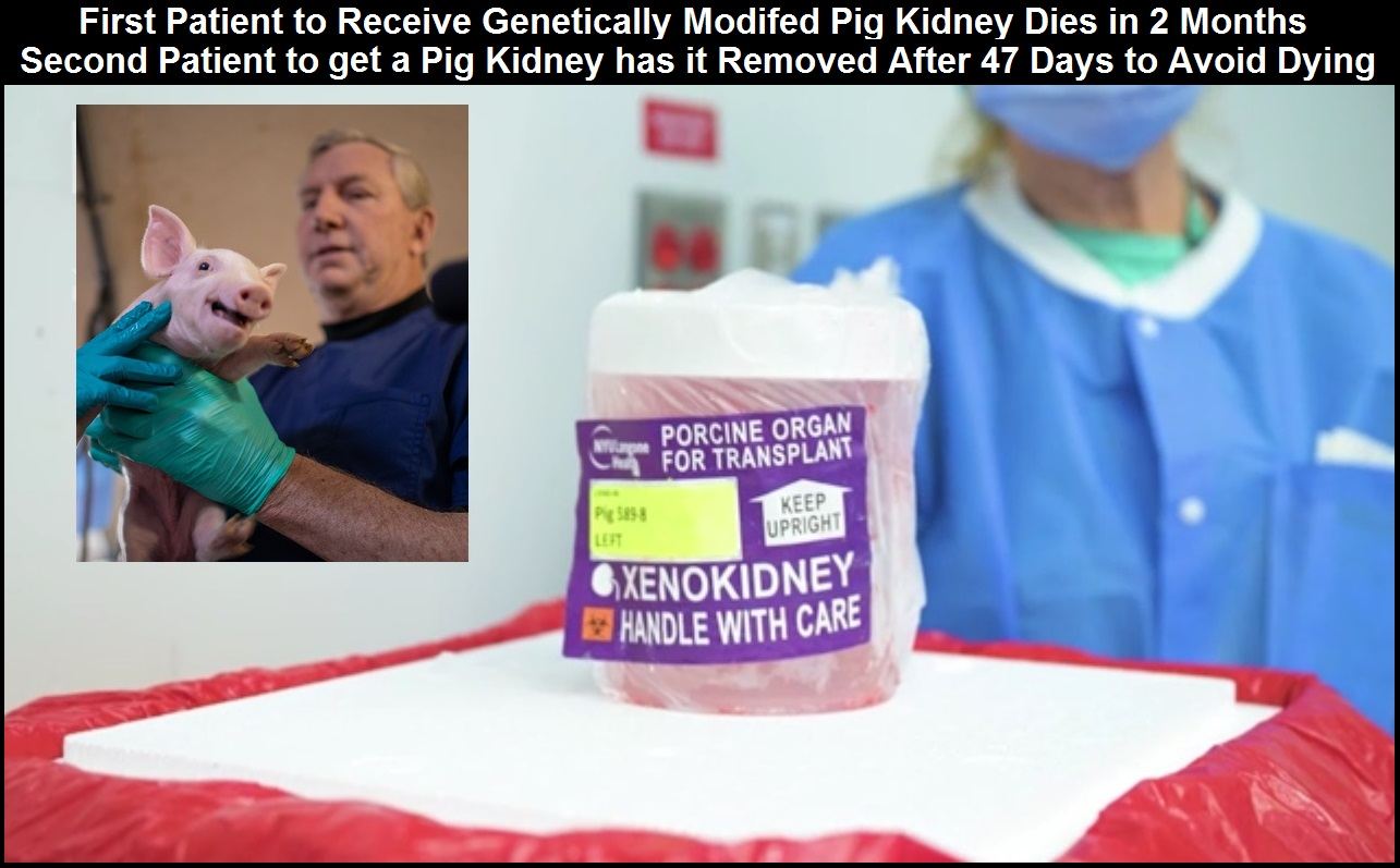 Pig-to-human-kidney-transplant-results-2